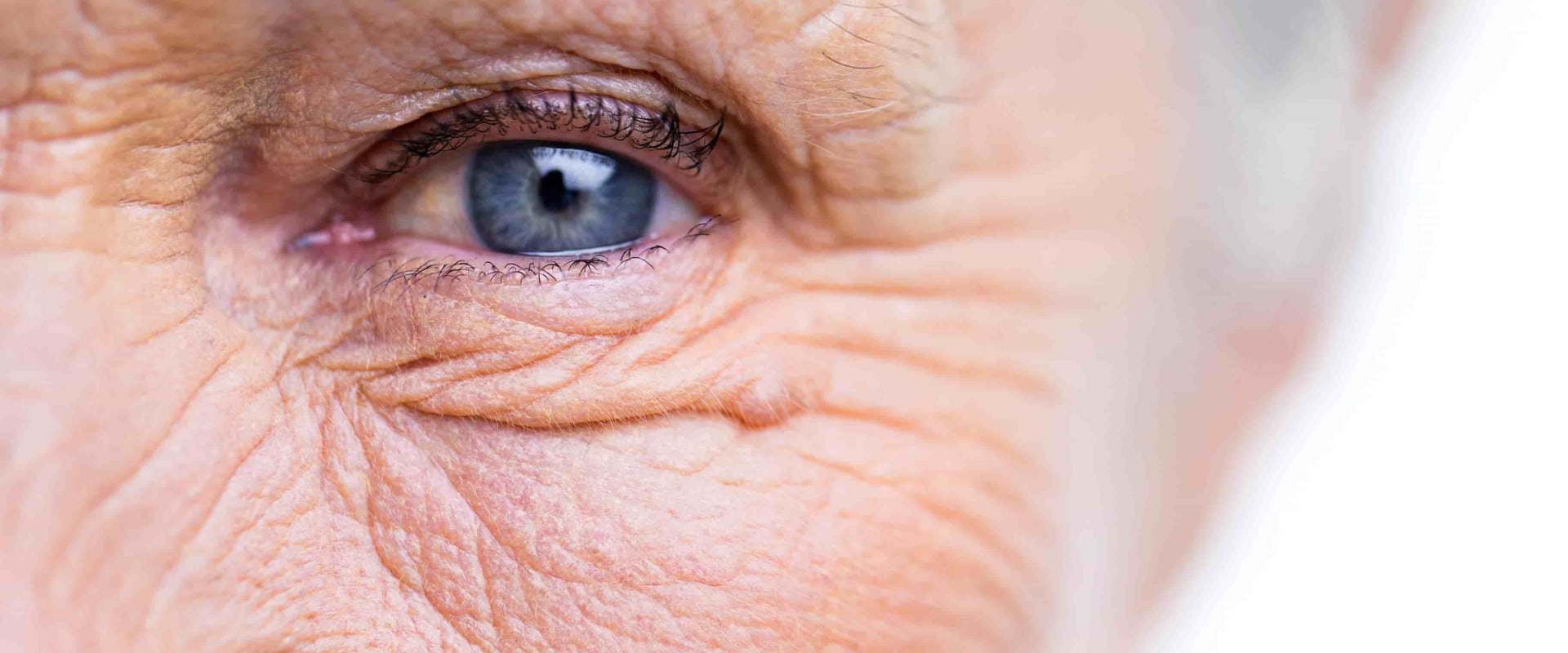 what-are-the-risks-of-bending-over-after-cataract-surgery